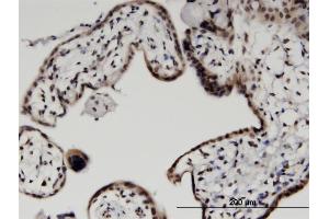 Immunoperoxidase of monoclonal antibody to HIST2H2BE on formalin-fixed paraffin-embedded human placenta.