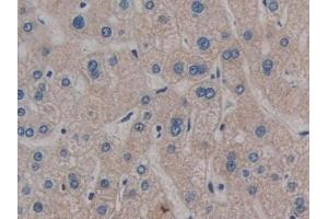 Detection of GPLD1 in Human Liver Tissue using Polyclonal Antibody to Glycosylphosphatidylinositol Specific Phospholipase D1 (GPLD1) (GPLD1 anticorps  (AA 496-840))