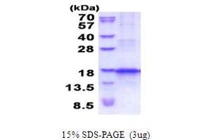 SDS-PAGE (SDS) image for Chemokine (C-C Motif) Ligand 25 (CCL25) (AA 24-150) protein (His tag) (ABIN5854118)