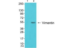 Western blot analysis of extracts from 293 cells (Lane 2), using Vimentin Antibody. (Vimentin anticorps  (C-Term))
