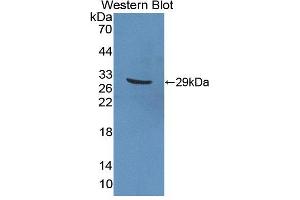 Western blot analysis of the recombinant protein. (PTPRN2 anticorps  (AA 782-1001))