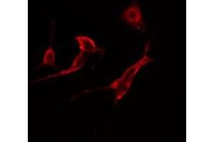 ABIN6277770 staining  HuvEc cells by IF/ICC. (CSNK2B anticorps  (Internal Region))
