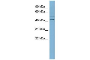 WB Suggested Anti-SLC46A1 Antibody Titration:  0. (SLC46A1 anticorps  (N-Term))