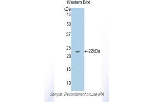Western blot analysis of the recombinant protein. (PLAT anticorps  (AA 359-532))