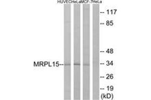 Western blot analysis of extracts from HeLa/HuvEc/MCF-7 cells, using MRPL15 Antibody.
