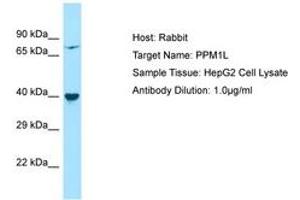 Image no. 1 for anti-Protein Phosphatase, Mg2+/Mn2+ Dependent, 1L (PPM1L) (AA 141-190) antibody (ABIN6750224) (PPM1L anticorps  (AA 141-190))