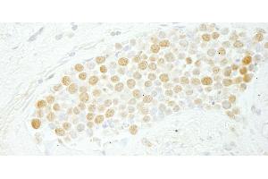 Immunohistochemistry (IHC) image for anti-CDC5 Cell Division Cycle 5-Like (S. Pombe) (CDC5L) (AA 752-802) antibody (ABIN7448468) (CDC5L anticorps  (AA 752-802))