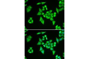 Immunofluorescence analysis of HeLa cells using ADSL antibody. (Adenylosuccinate Lyase anticorps  (AA 1-310))
