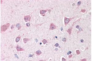 Human Brain, Cortex (formalin-fixed, paraffin-embedded) stained with ING3 antibody ABIN291938 at 2. (ING3 anticorps  (AA 294-304))