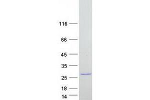 Validation with Western Blot