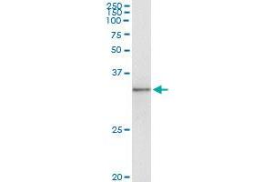 Immunoprecipitation of TOLLIP transfected lysate using anti-TOLLIP monoclonal antibody and Protein A Magnetic Bead , and immunoblotted with TOLLIP monoclonal antibody.