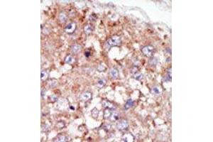 Image no. 2 for anti-PTK6 Protein tyrosine Kinase 6 (PTK6) (N-Term) antibody (ABIN359990) (PTK6 anticorps  (N-Term))