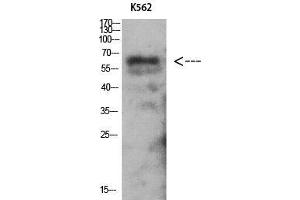 Western Blot (WB) analysis of K562 using Antibody diluted at 1:1000. (PRKAG2 anticorps  (N-Term))