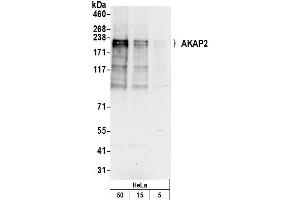 anti-A Kinase (PRKA) Anchor Protein 2 (AKAP2) (AA 75-125) antibody