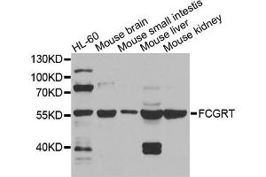 Western blot analysis of extracts of various cell lines, using FCGRT antibody. (FcRn anticorps)