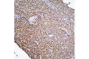 IHC analysis of PHF21A using anti-PHF21A antibody (ABIN6719353). (PHF21A anticorps  (AA 1-97))