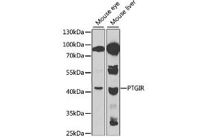 Western blot analysis of extracts of various cell lines, using PTGIR antibody. (Prostacyclin Receptor anticorps)