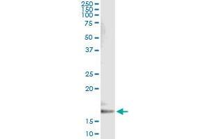 Immunoprecipitation of CYB5A transfected lysate using anti-CYB5A monoclonal antibody and Protein A Magnetic Bead , and immunoblotted with CYB5A MaxPab rabbit polyclonal antibody.