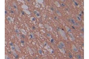 Detection of GAP43 in Human Glioma Tissue using Polyclonal Antibody to Growth Associated Protein 43 (GAP43)