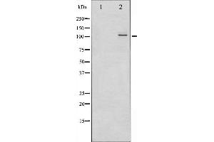 Western blot analysis of NF- kappaB p100/p52 phosphorylation expression in ovary cancer whole cell lysates,The lane on the left is treated with the antigen-specific peptide.
