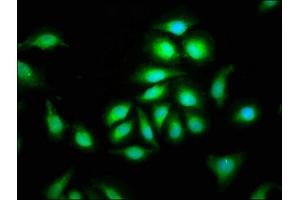 Immunofluorescence staining of A549 cells with ABIN7147387 at 1:100, counter-stained with DAPI. (CEP135 anticorps  (AA 94-195))