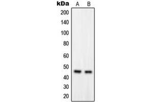 Western blot analysis of GPRC5B expression in HUVEC (A), Jurkat (B) whole cell lysates.
