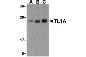 Western Blotting (WB) image for anti-Tumor Necrosis Factor (Ligand) Superfamily, Member 15 (TNFSF15) (N-Term) antibody (ABIN1031618) (TNFSF15 anticorps  (N-Term))