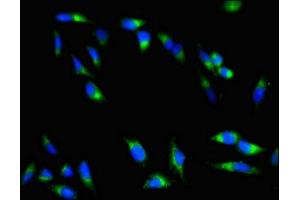 Immunofluorescent analysis of Hela cells using ABIN7147742 at dilution of 1:100 and Alexa Fluor 488-congugated AffiniPure Goat Anti-Rabbit IgG(H+L) (Chymotrypsin anticorps  (AA 90-220))