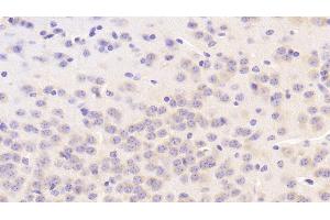 Detection of VAV1 in Mouse Cerebrum Tissue using Polyclonal Antibody to Vav 1 Oncogene (VAV1) (VAV1 anticorps  (AA 565-795))