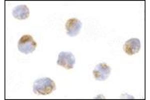 Immunocytochemistry of Mcl-1 in Raji cells with this product at 10 μg/ml. (MCL-1 anticorps  (Center))