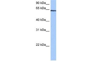 WB Suggested Anti-TTC6 Antibody Titration:  0.