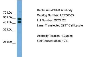 Western Blotting (WB) image for anti-Phosphoglucomutase 1 (PGM1) (Middle Region) antibody (ABIN785805) (Phosphoglucomutase 1 anticorps  (Middle Region))
