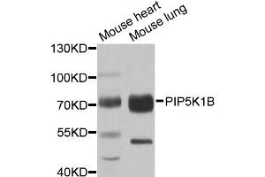 Western blot analysis of extracts of various cell lines, using PIP5K1B antibody. (PIP5K1B anticorps)