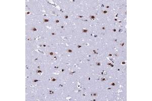 Immunohistochemical staining of human cerebral cortex with PRAMEF12 polyclonal antibody  shows strong nuclear positivity in neuronal cells. (PRAMEF12 anticorps)