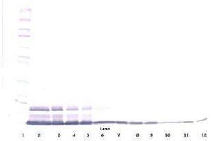Image no. 2 for anti-Interleukin 8 (IL8) antibody (ABIN465358) (IL-8 anticorps)