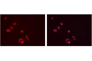 ABIN6277388 staining Hela cells by IF/ICC. (IGFBP7 anticorps  (Internal Region))