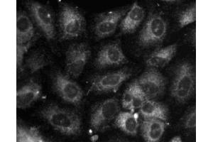 Immunofluorescent staining of A549 (ATCC CCL-185) cells. (Calnexin anticorps  (AA 116-301))