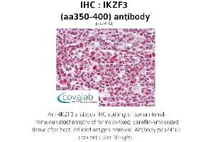 Image no. 1 for anti-IKAROS Family Zinc Finger 3 (Aiolos) (IKZF3) (AA 350-400) antibody (ABIN1735871) (IKZF3 anticorps  (AA 350-400))