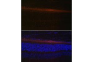 Immunofluorescence analysis of rat retina using RDH5 Polyclonal Antibody (ABIN6130851, ABIN6146839, ABIN6146840 and ABIN6224076) at dilution of 1:100 (40x lens).
