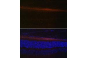 Immunofluorescence analysis of rat retina using RDH5 Polyclonal Antibody (ABIN6130851, ABIN6146839, ABIN6146840 and ABIN6224076) at dilution of 1:100 (40x lens). (RDH5 anticorps  (AA 24-318))