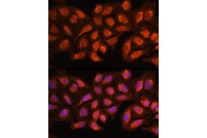 Immunofluorescence analysis of Hela cells using MRPL45 Rabbit pAb (ABIN6133218, ABIN6144020, ABIN6144021 and ABIN6217105) at dilution of 100 (40x lens).