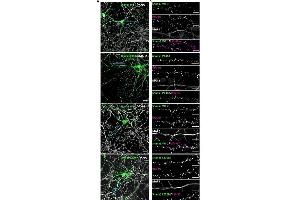 Primary hippocampal neurons expressing GFP-Shank3 (WT or P141A, L270M mutants) were fixed and stained for the postsynaptic marker PSD-95 and the dendritic marker MAP2 (gray).