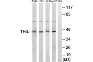 Western blot analysis of extracts from HepG2/Jurkat/293/A549 cells, using ACAT1 Antibody. (ACAT1 anticorps  (AA 221-270))