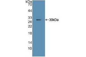Detection of Recombinant Ki67P, Human using Polyclonal Antibody to Ki-67 Protein (Ki-67) (Ki-67 anticorps  (AA 3088-3235))