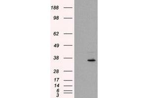 HEK293T cells were transfected with the pCMV6-ENTRY control (Left lane) or pCMV6-ENTRY FAHD2A (Right lane) cDNA for 48 hrs and lysed. (FAHD2A anticorps)