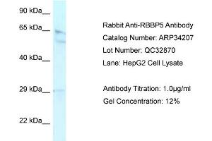 WB Suggested Anti-RBBP5 Antibody Titration:  0. (RBBP5 anticorps  (Middle Region))