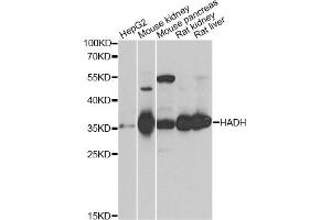 Western blot analysis of extracts of various cell lines, using HADH antibody. (HADH anticorps)