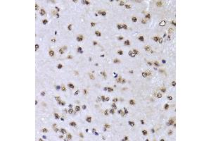 Immunohistochemistry of paraffin-embedded mouse brain using EFTUD2 Antibody (ABIN5974236) at dilution of 1/100 (40x lens). (EFTUD2 anticorps)