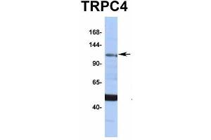 Host:  Rabbit  Target Name:  TRPC4  Sample Type:  MCF7  Antibody Dilution:  1.