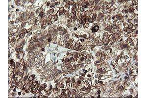 Image no. 4 for anti-Transmembrane Protein 173 (TMEM173) antibody (ABIN1501428)